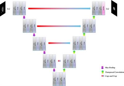 Application of FGD-BCEL loss function in segmenting temporal lobes on localized CT images for radiotherapy